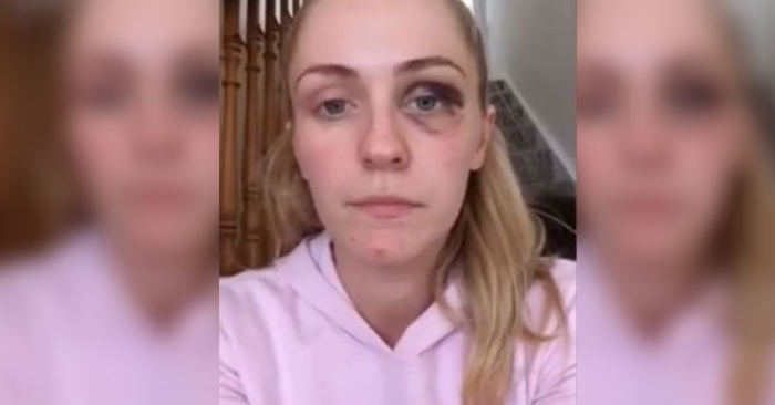 Kjæresten banket henne gang på gang. Helt til hun spilte inn DENNE videoen: